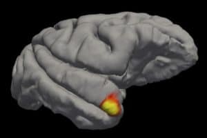 An area (red-yellow) in the brain's temporal pole specializes in familiar face recognition.