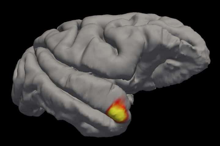 An area (red-yellow) in the brain's temporal pole specializes in familiar face recognition.