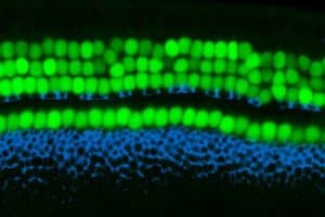 The organ of Corti, the hearing organ of the inner ear, contains rows of sensory hearing cells (green) surrounded by supporting cells (blue). (Image by Yassan Abdolazimi/Segil Lab/USC Stem Cell)