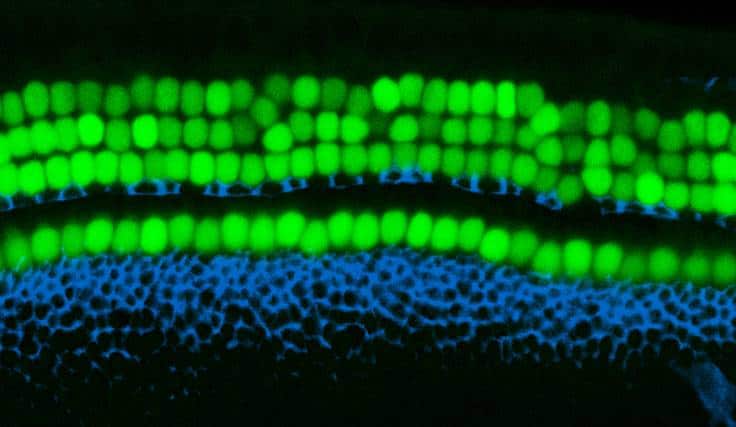 The organ of Corti, the hearing organ of the inner ear, contains rows of sensory hearing cells (green) surrounded by supporting cells (blue). (Image by Yassan Abdolazimi/Segil Lab/USC Stem Cell)