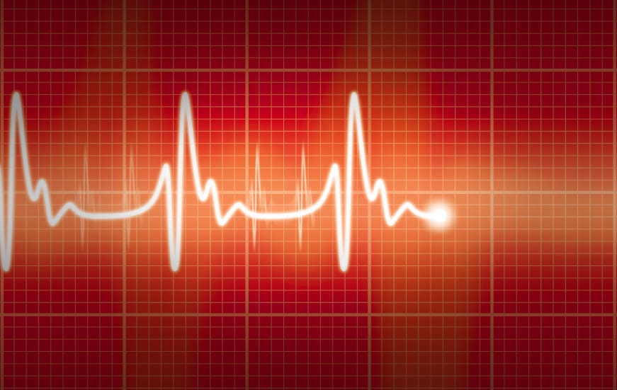 AI Algorithm Matches Cardiologists’ Expertise, While Explaining Its Decisions