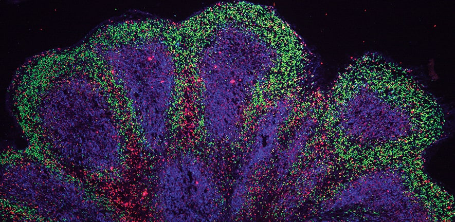 Lab-grown ‘mini brains’ hint at treatments for neurodegenerative diseases