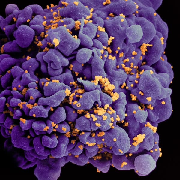NIH researchers identify how two people controlled HIV after stopping treatment