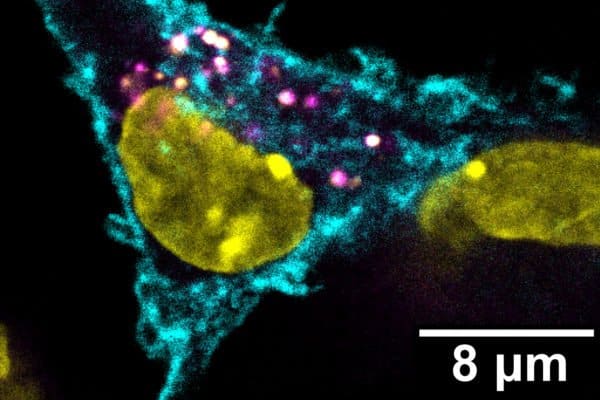 A stealthy way to combat tumors