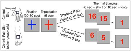 Not So Great Expectations: Pain in HIV Related to Brain’s Expectations of Relief