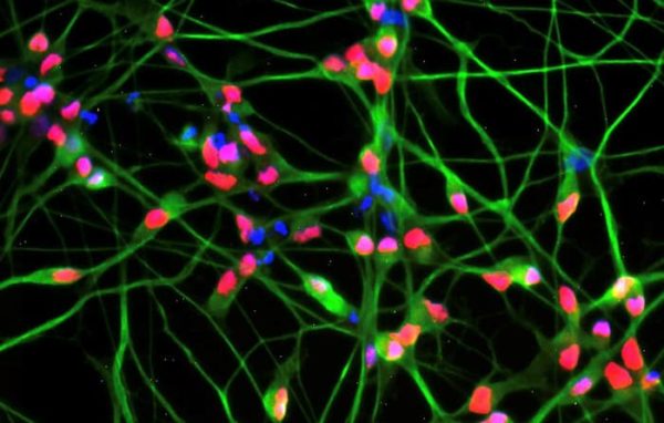 Study adds evidence that altered fat metabolism, enzyme, plays key role in Lou Gehrig’s disease