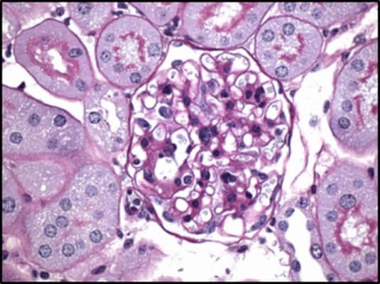 Experimental compound counters diabetic complications