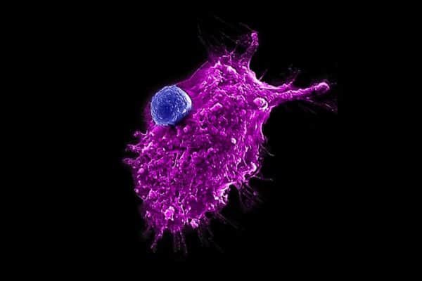 ‘Off-the-shelf’ immune cell therapy for cancer