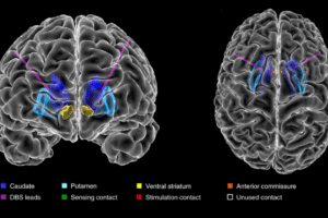 Brain scan image.