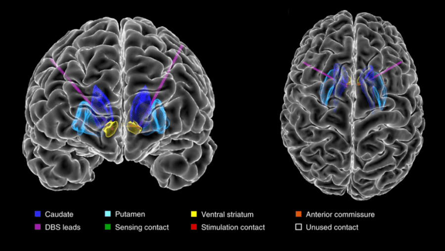 Brain scan image.