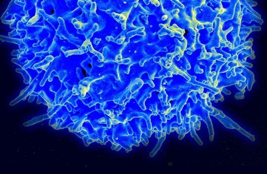 Microscopic image of a human T cell. T cells are the focus of current immunotherapies, however, researchers found that tumors contain a wide range of other immune cells, such as macrophages, NK and B cells. Image by NIH.