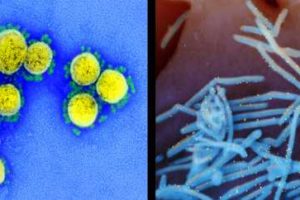 Microscopy images of SARS-CoV-2 (left), the virus that causes COVID-19, and respiratory syncytial virus, a major pediatric respiratory virus. Images courtesy of the NIH.