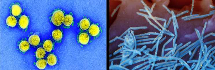 Microscopy images of SARS-CoV-2 (left), the virus that causes COVID-19, and respiratory syncytial virus, a major pediatric respiratory virus. Images courtesy of the NIH.