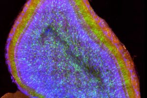Section of a mouse brain observed using a fluorescence microscope.