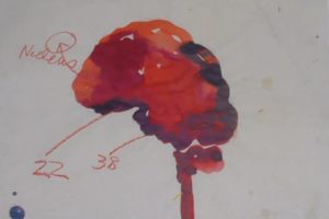 blood brain barrier illustration