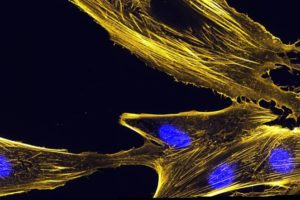 Plastin is a protein that assembles actin bundles, like those pictured here in muscle precursor cells called myoblasts.