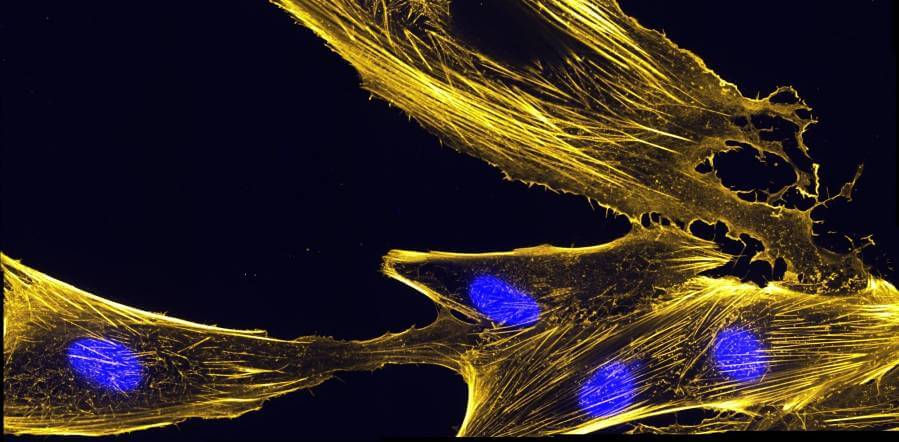 Plastin is a protein that assembles actin bundles, like those pictured here in muscle precursor cells called myoblasts.