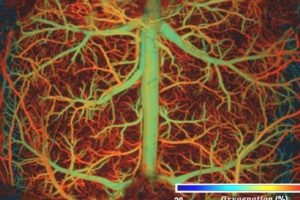 The image shows the vasculature of the brain, and the colors illuminate how capillaries experience varying levels of oxygenation as the brain undergoes hypoxia.