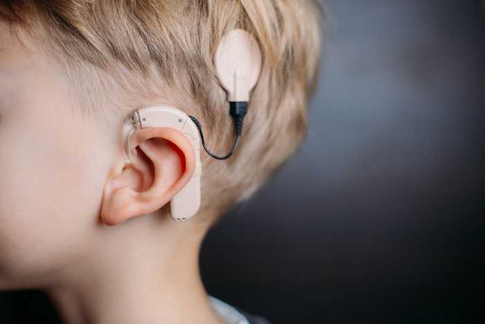 Cochlear implants are more beneficial to deaf children with learning disabilities than hearing aids.