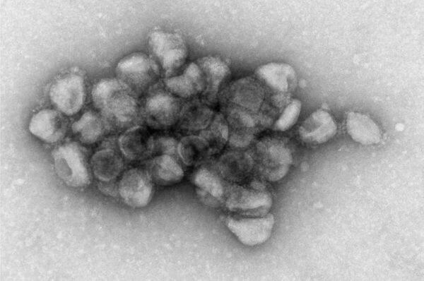Electron microscopy image of an aggregate of pseudotyped viral particles bearing the SARS-CoV-2 Delta variant spike proteinNICHD
