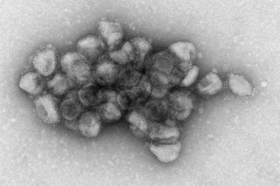Electron microscopy image of an aggregate of pseudotyped viral particles bearing the SARS-CoV-2 Delta variant spike proteinNICHD