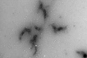 Picture of amyloid from the SARS-CoV-2 virus’ spike protein. Seen using an electron microscope. When the spike protein is mixed with the enzyme neutrophil elastase in test tubes, branched protein fibrils are created, which can cause disturbed blood coagulation in patients with COVID-19. Sofie Nyström, Per Hammarström