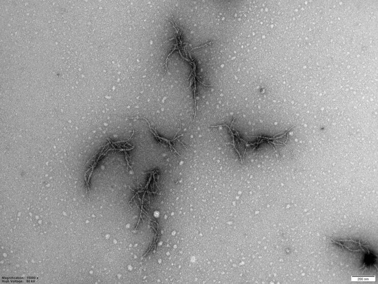 Picture of amyloid from the SARS-CoV-2 virus’ spike protein. Seen using an electron microscope. When the spike protein is mixed with the enzyme neutrophil elastase in test tubes, branched protein fibrils are created, which can cause disturbed blood coagulation in patients with COVID-19. Sofie Nyström, Per Hammarström