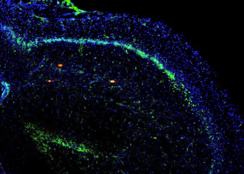 The newly discovered circuit facilitates the ability to focus attention on what’s important in the environment and ignore other sensory stimuli, said the study’s lead author, Ruchi Malik, PhD. “It’s as if the PFC is taking in all of this sensory information and saying ‘Hey, hippocampus, we’re here in this particular context, so pay attention to this particular information right now,’” Malik said. She gives the example of a parking lot as a context in which the PFC exerts that kind of top-down control over the hippocampus. “To remember where you parked, the PFC would tell the hippocampus to selectively pay attention to landmarks, and then recall and seek out those landmarks when you return,” said Malik. Fine-Tuning Attention by Inhibiting Neurons Most unique about this circuit is the complex way that it accomplishes the task of focusing attention: it heightens and focuses activity in specific microcircuits of the hippocampus by turning off signals that would otherwise tamp down those microcircuits. The result is a very clear signal from the PFC telling the hippocampus what to attend to, and an extremely deft means of fine-tuning that message as surroundings change. The team showed this by putting mice into a small arena for 10 minutes, where there were a few small objects. While exploring the arena, the mice would inspect the objects for a minute or two, and then move on. By looking at activity in the brains of the mice, the researchers saw that the signals between the two brain regions synchronized. When a mouse passed that object again, the researchers could see that the signals within the hippocampus were refined and enhanced. “There was this dialogue happening; the hippocampus was mapping the locations of objects in space and the PFC was instructing the hippocampus on the relevance of each location,” said Malik. The team also found that data indicated which neurons were firing at a given time and identify where the mouse was at that moment, confirming that brain activity changes as the mouse approaches or investigates an object that the PFC has deemed important. This suggests that as the hippocampus is mapping the environment, it is also becoming fine-tuned to produce certain patterns of neural activity when the prefrontal cortex detects that the mouse is approaching an important target such as a new object. Dysfunction of Brain Circuit May Be Linked to Dementia, ADHD The team would like to get a better sense of the role this circuit might play in executive function, and what the consequences are when it’s not able to do its job effectively. Malik believes that dysfunction in this pathway may underlie cognitive issues related to attention or memory, such as dementia, ADHD or psychiatric disorders. Their next move toward that goal is to get a sense of how this circuit impacts behavior by looking at how it functions during more complex activities, like using information stored in working memory to decide which path to follow to find a reward. Malik thinks it’s likely that this connection from the higher-order, cognitive part of the brain to the more ancient and universal wayfinding center may exert broad influence. “To operate in a complex environment, to go look for food or rewards and then come back, you need to be able to pay attention to specific stimuli and arrange them in space in a precise way,” she said. “The filtering job of this circuit is absolutely essential.” This research was supported by NIMH grants R01MH106507 and R01MH117961. Additional authors: Yi LI, MD and Selin Schamiloglu, both of UCSF.