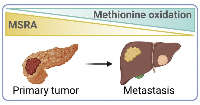 UC Berkeley and Columbia University scientists have found that pancreatic cancer cells (left) readily metastasize because these tumors suppress levels of an enzyme, MSRA, that pulls oxygen atoms off amino acids called methionine. As MSRA levels decrease, methionines on proteins become more oxidized. This causes one particular protein to rev up energy production in the tumor, promoting the migration of cancer cells to other organs. Metastatic tumors on the liver (right) lead to rapid death.