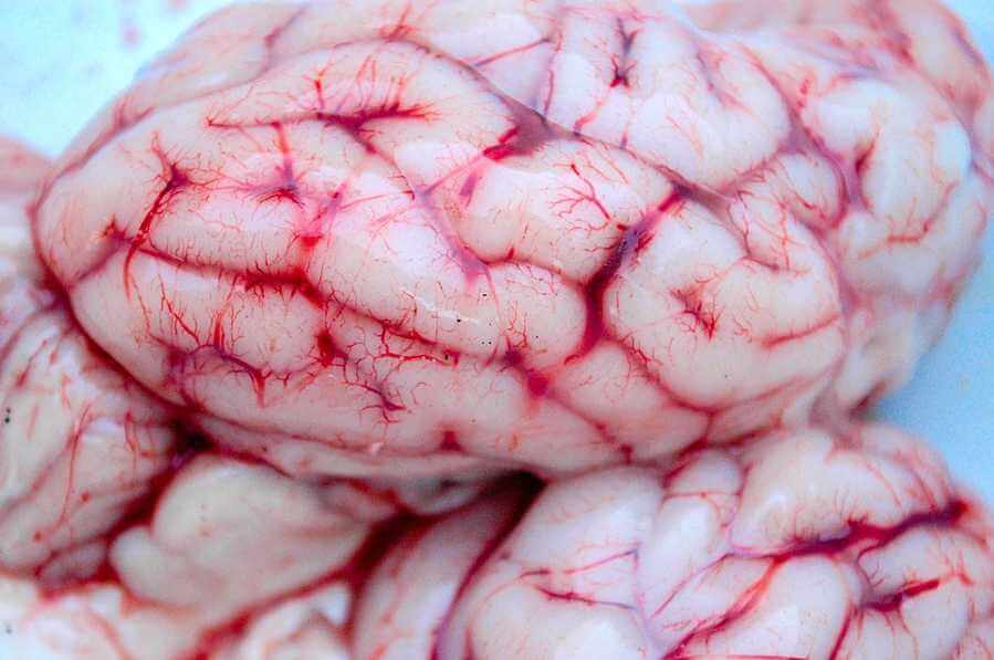 Brain closeup