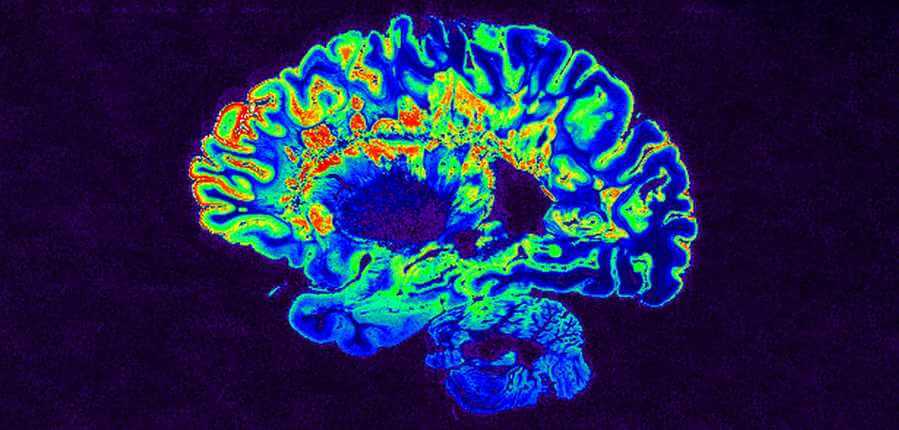 IA leads the charge against multiple sclerosis