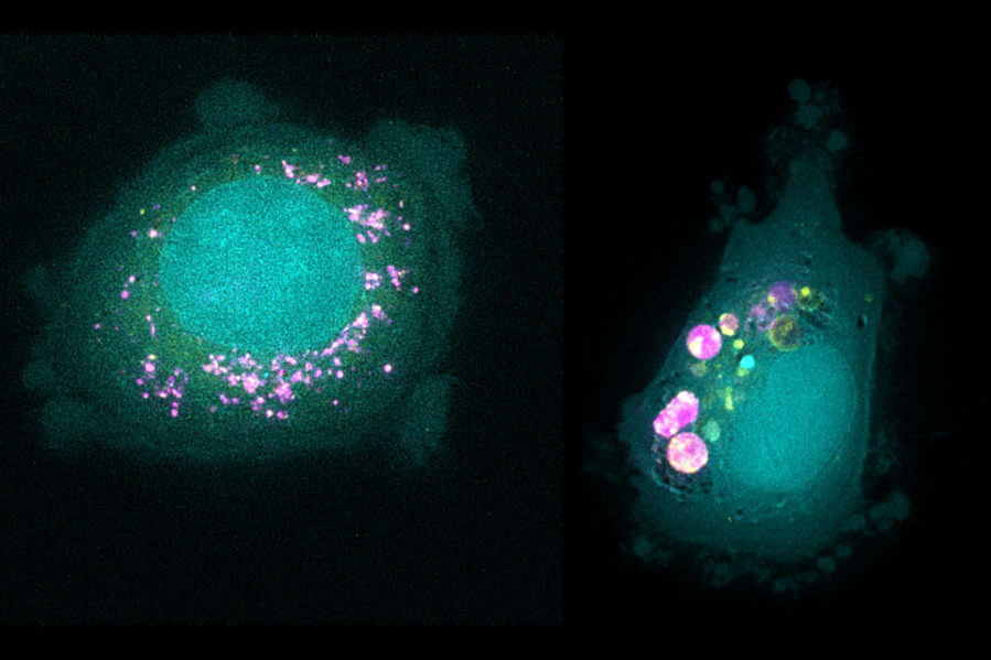 How different cancer cells respond to drug-delivering nanoparticles ...