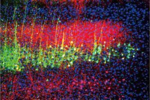 Sound reduces pain in mice by lowering the activity of neurons in the brain’s auditory cortex (green and magenta) that project to the thalamus. Wenjie Zhou