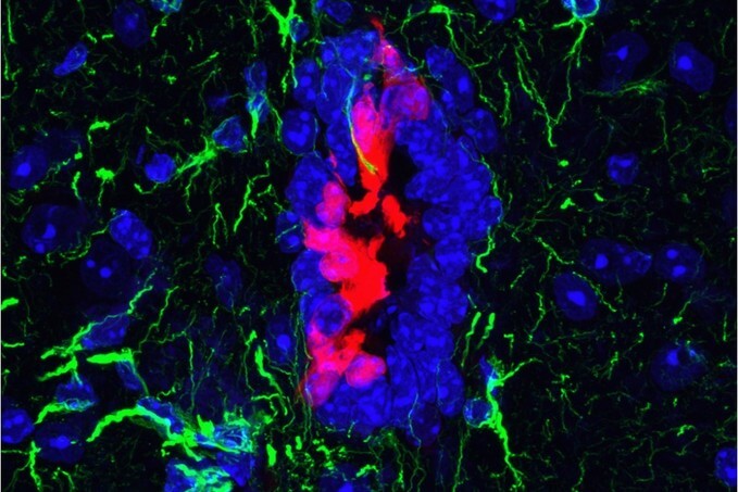 Image of uninjured mice spinal cord, with ependymal cells shown in red.