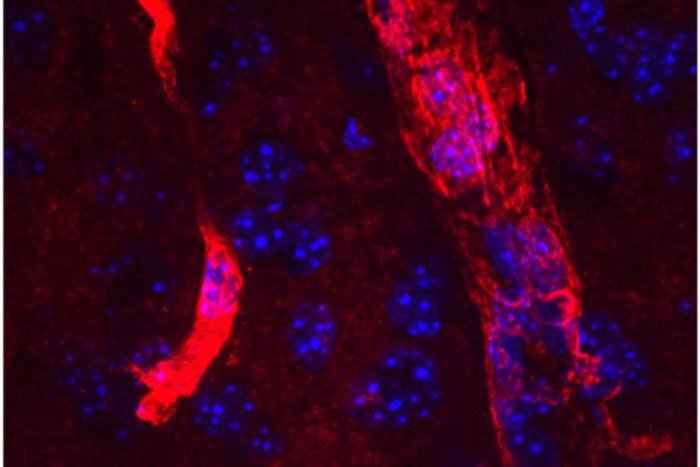 An extended form of the protein aquaporin 4 (red) lines the edges of tiny blood vessels in the brain. Cell nuclei are visible in blue. Researchers at Washington University School of Medicine in St. Louis have found a new druggable pathway that enhances the amount of long aquaporin 4 near blood vessels and increases the clearance of waste from the brain. The findings potentially could lead to new therapies to prevent Alzheimer’s dementia.