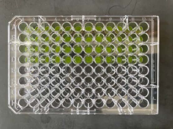 The activity of synthetic genetic circuits that process the presence or absence of specific signals in plant leaves was measured in high throughput by placing leaf punches in 96-well plates. When the correct combinations of inputs are delivered to leaves, they fluoresce green, and the fluorescence can be measured using a plate reader. (Image credit: Jennifer Brophy)