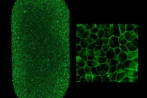Left shows an image of the full-RPE-patch (2 x 4 mm). Each dot is an RPE cell with the borders stained green. Each patch contains approximately 75,000 RPE cells. Right image shows patch RPE cells at higher magnification.Kapil Bharti, Ph.D., NEI
