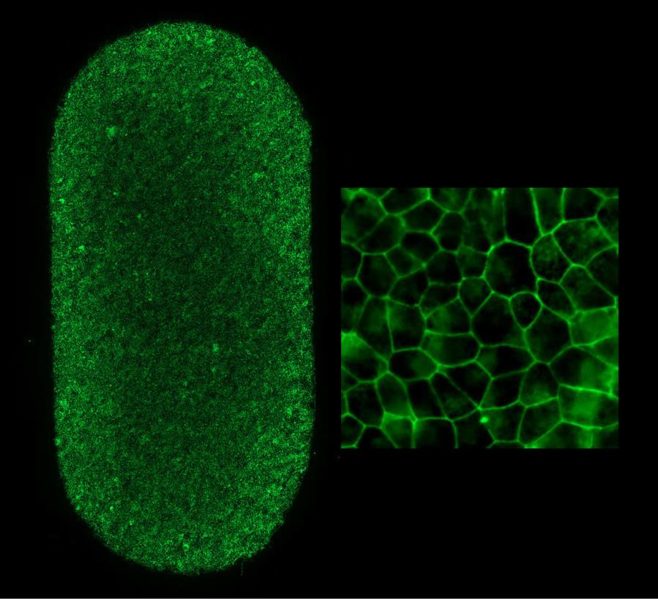 Left shows an image of the full-RPE-patch (2 x 4 mm). Each dot is an RPE cell with the borders stained green. Each patch contains approximately 75,000 RPE cells. Right image shows patch RPE cells at higher magnification.Kapil Bharti, Ph.D., NEI