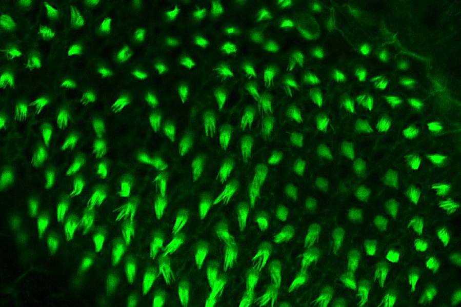 Confocal image of adult zebrafish hair cells (green) in the auditory organ of the inner ear. Erin Jimenez, Ph.D., NHGRI.