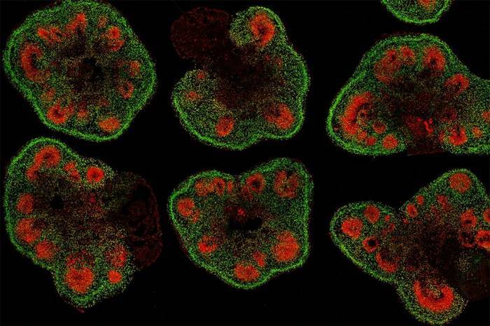 Slices of mini–brain organoids with neural stem cells (red) and cortical neurons (green).