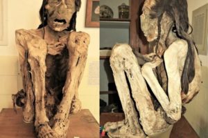 The Marburg male mummy – macroscopic views of the whole mummy