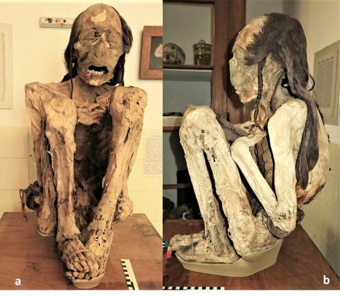 The Marburg male mummy – macroscopic views of the whole mummy