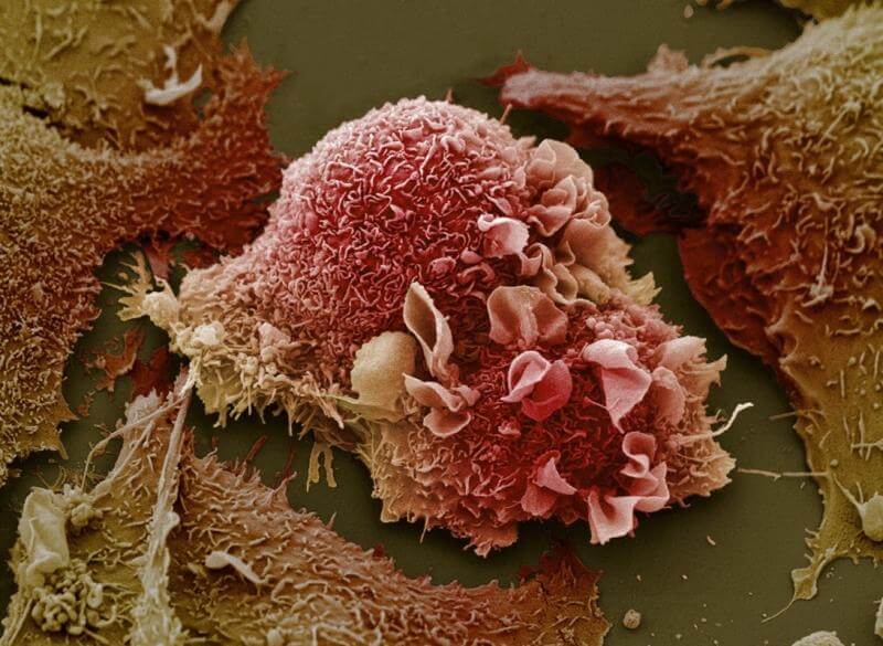 Cancer cell close-up