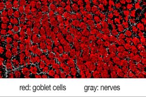 Harvard Medical School researchers have analyzed the molecular crosstalk between pain fibers in the gut and goblet cells that line the walls of the intestine. The work shows that chemical signals from pain neurons induce goblet cells to release protective mucus that coats the gut and shields it from damage. The findings show that intestinal pain is not a mere detection-and-signaling system, but plays a direct protective role in the gut.