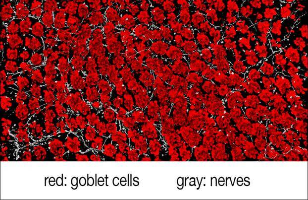 Harvard Medical School researchers have analyzed the molecular crosstalk between pain fibers in the gut and goblet cells that line the walls of the intestine. The work shows that chemical signals from pain neurons induce goblet cells to release protective mucus that coats the gut and shields it from damage. The findings show that intestinal pain is not a mere detection-and-signaling system, but plays a direct protective role in the gut.