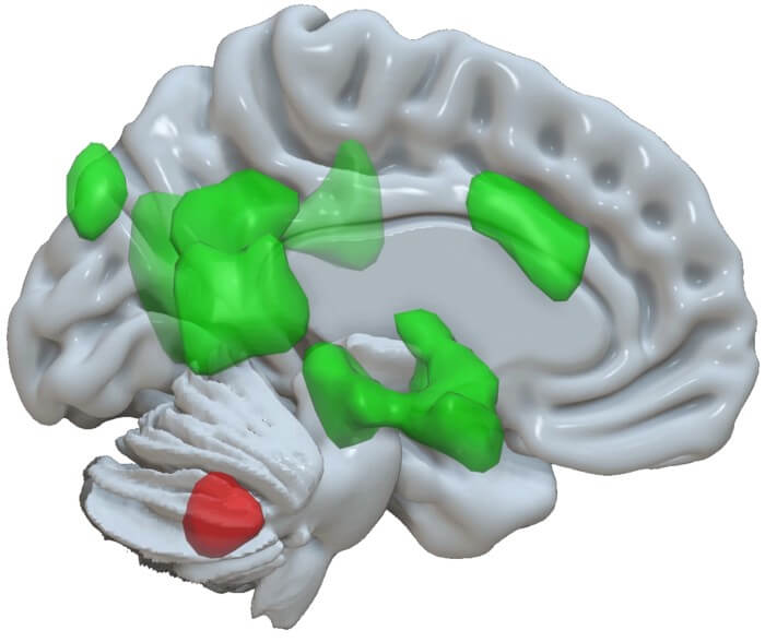 The cerebellum (activation in red) communicates with various areas of the cerebrum (activations in green) to enhance storage of emotional information.