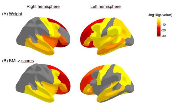 The cortical thickness of prefrontal regions is negatively associated with weight and BMI measurements, meaning that higher weight and BMI are related to lower cortical thickness.
