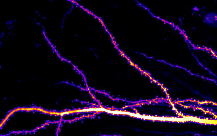 Compared to wild type control mice, hippocampal neurons in PKCa M489V mice showed fewer dendritic spines.