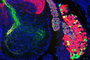 Different populations of sensory neurons cell bodies in a dorsal root ganglion (right) and their axons in the spinal cord (left): The cells in green detect proprioceptive information while the cells in red thermal and tactile information.