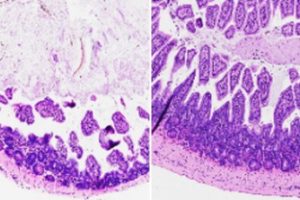 Salk researchers discovered the compound FexD can treat intestinal inflammation in mice. Mice with symptoms similar to inflammatory bowel disease had changes to the cells lining their intestines (left) that were reversed with treatment (right).